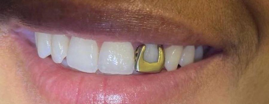 Gold removal before